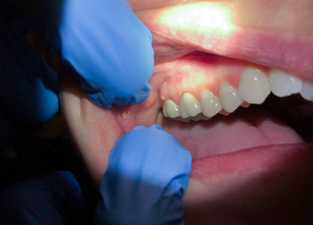 Best Emergency Orthodontic Services in Sharon, MS